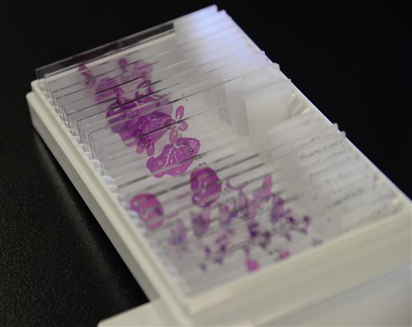 數位化病理組織分析平台